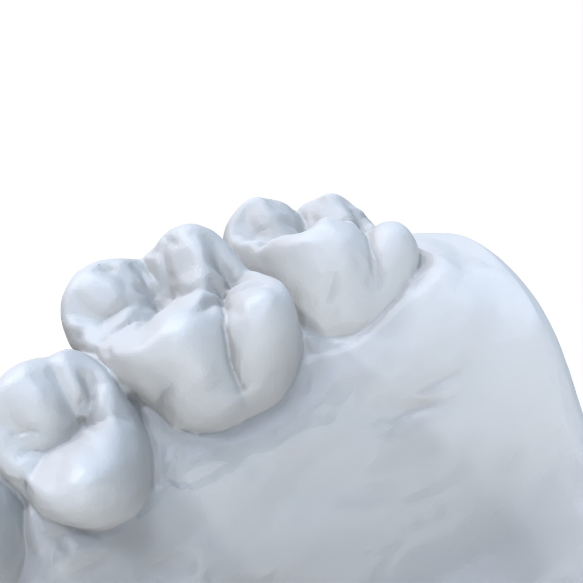 1 PCS Dental Model Preferred 3 - 3D Printing Dental review and price